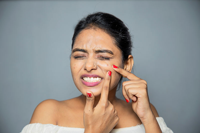 What Is The Most Effective Treatment For Acne Scars?