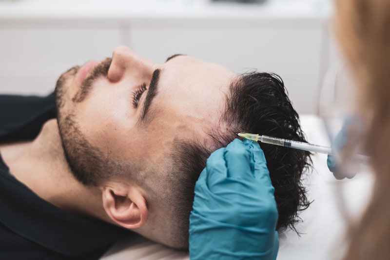 PRP Hair Loss Injections – Everything You Need to Know