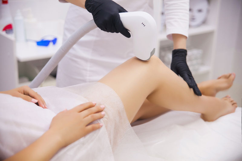 Laser Hair Removal in Delhi for Face: What to Expect, Safety and Results