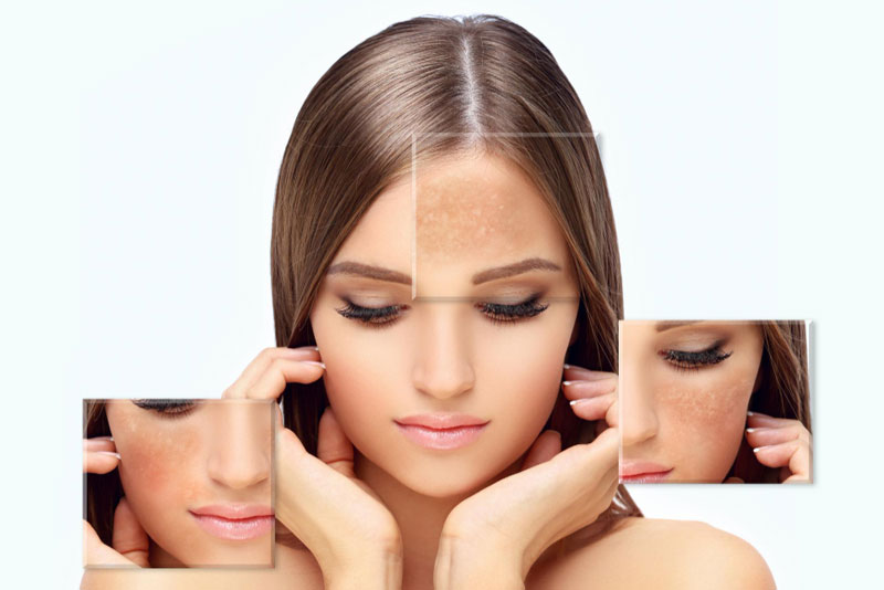Pigmentation Treatment in Delhi: A Dermatologist’s Complete Guide to Causes, Prevention and Treatment  
