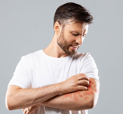 Bacterial Skin Infection Treatment in Delhi