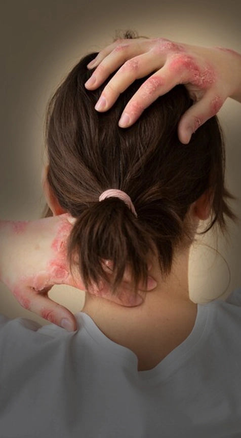 Skin Clinic In Delhi