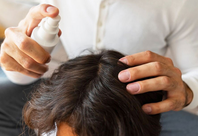 Hair Fall Treatment