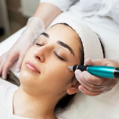 Microneedling / PRP