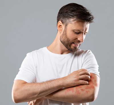 Allergy Treatment in Delhi