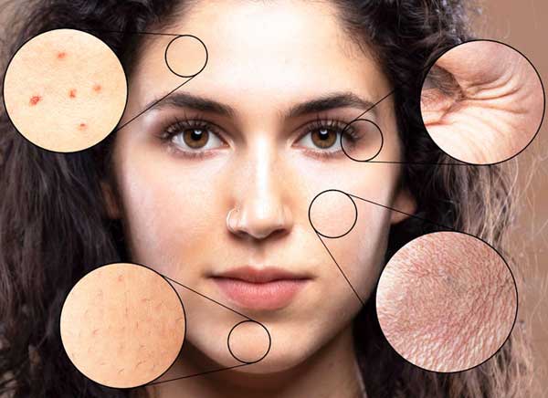 Skin Conditions