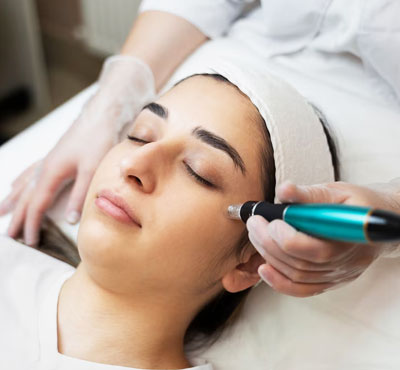 vampire facial treatment in delhi
